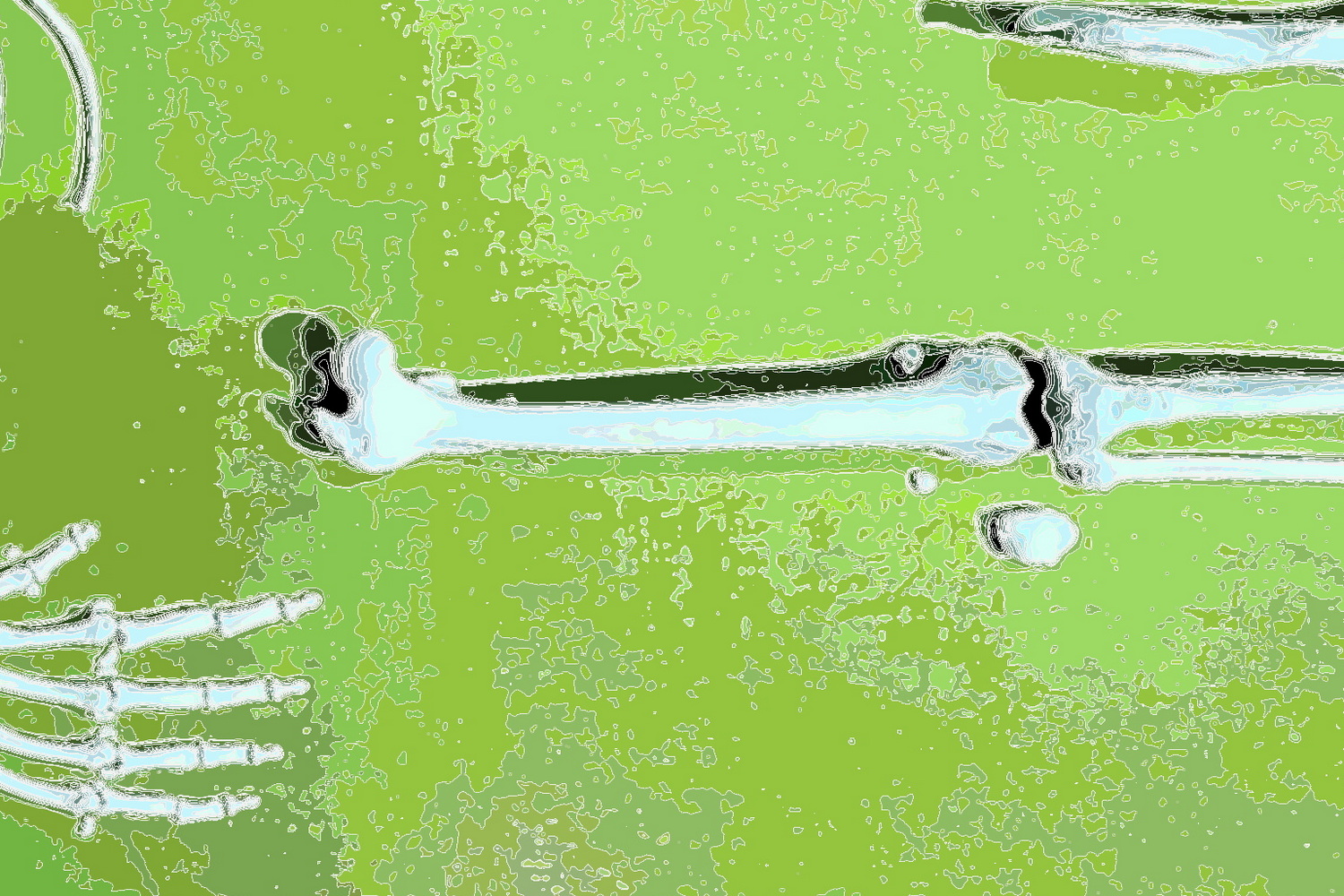 Bones lying in a meadow